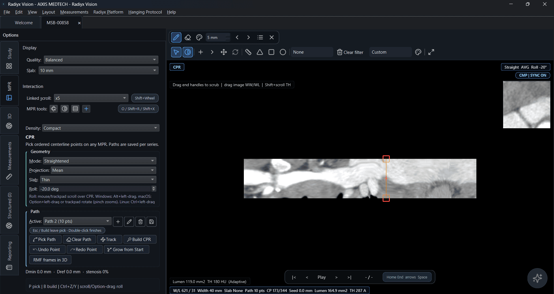 Radiyx Vision CPR result — straightened reformation and vessel-focused review