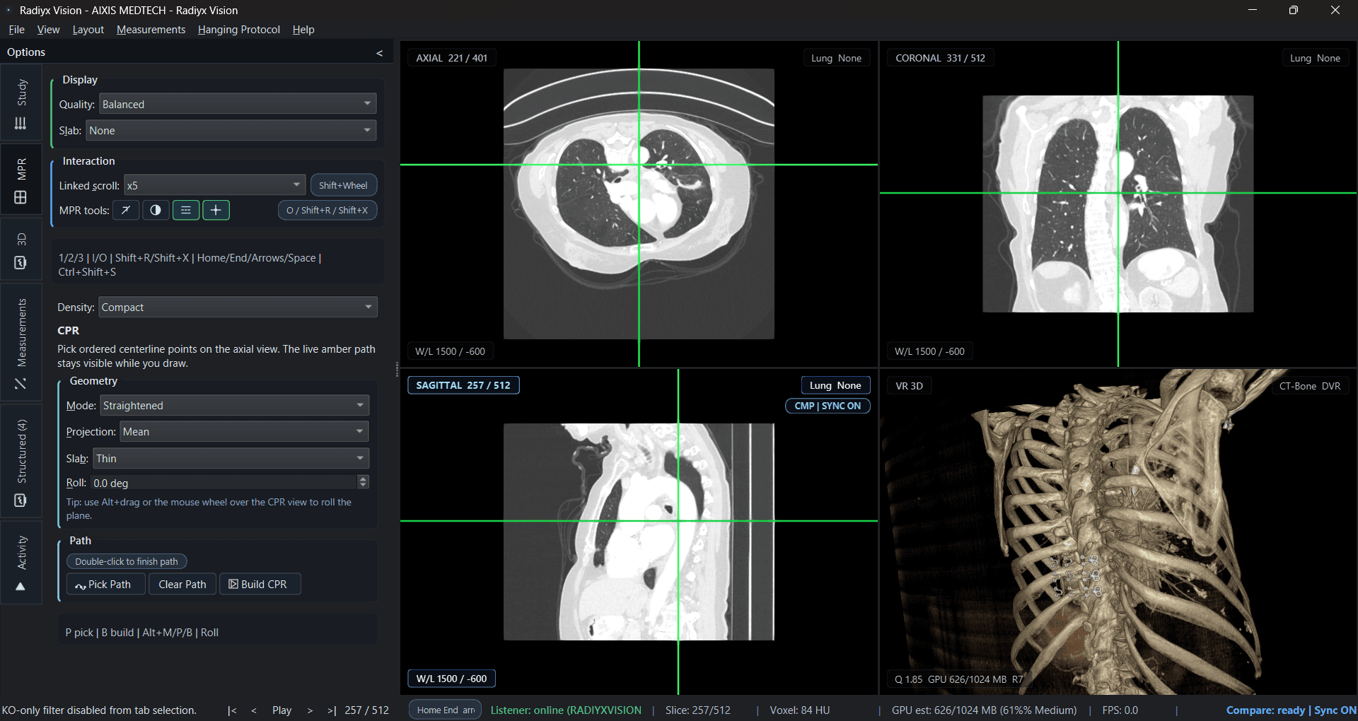 Radiyx Vision free advanced diagnostic workstation