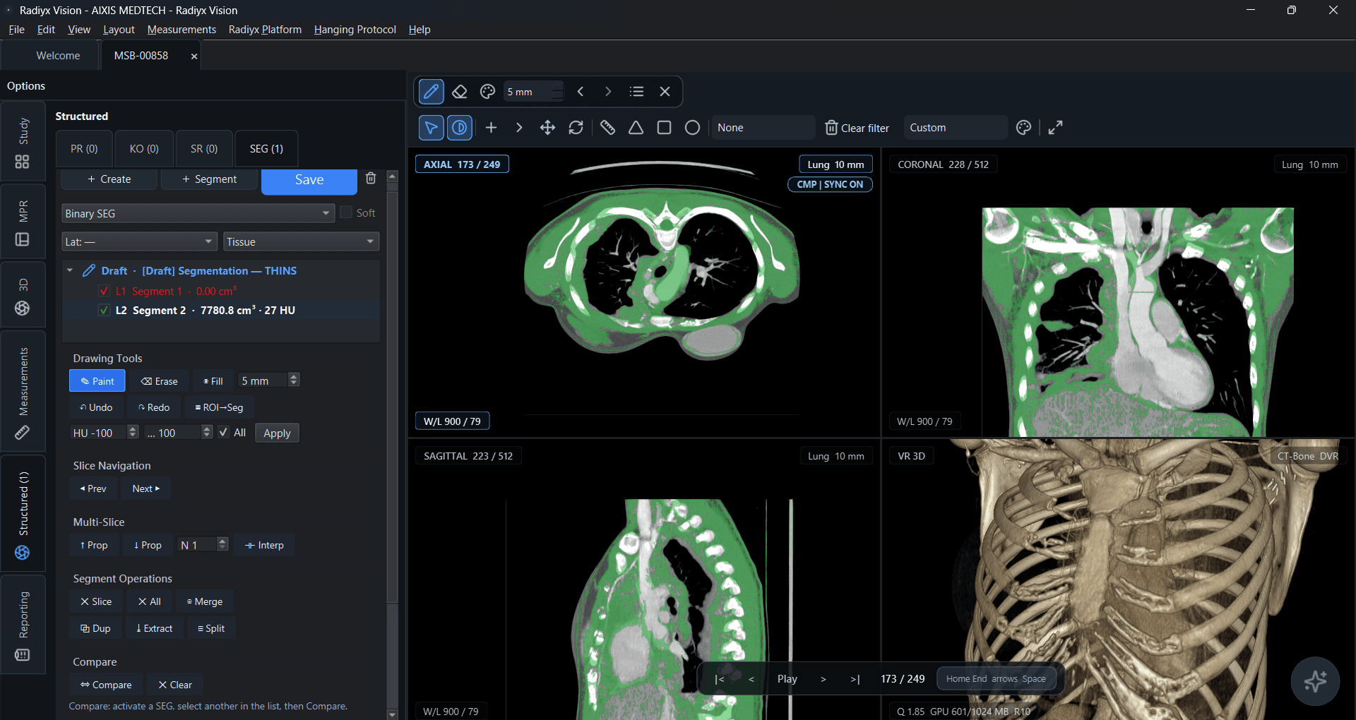 Radiyx Vision segmentation interface integrated into the imaging workspace