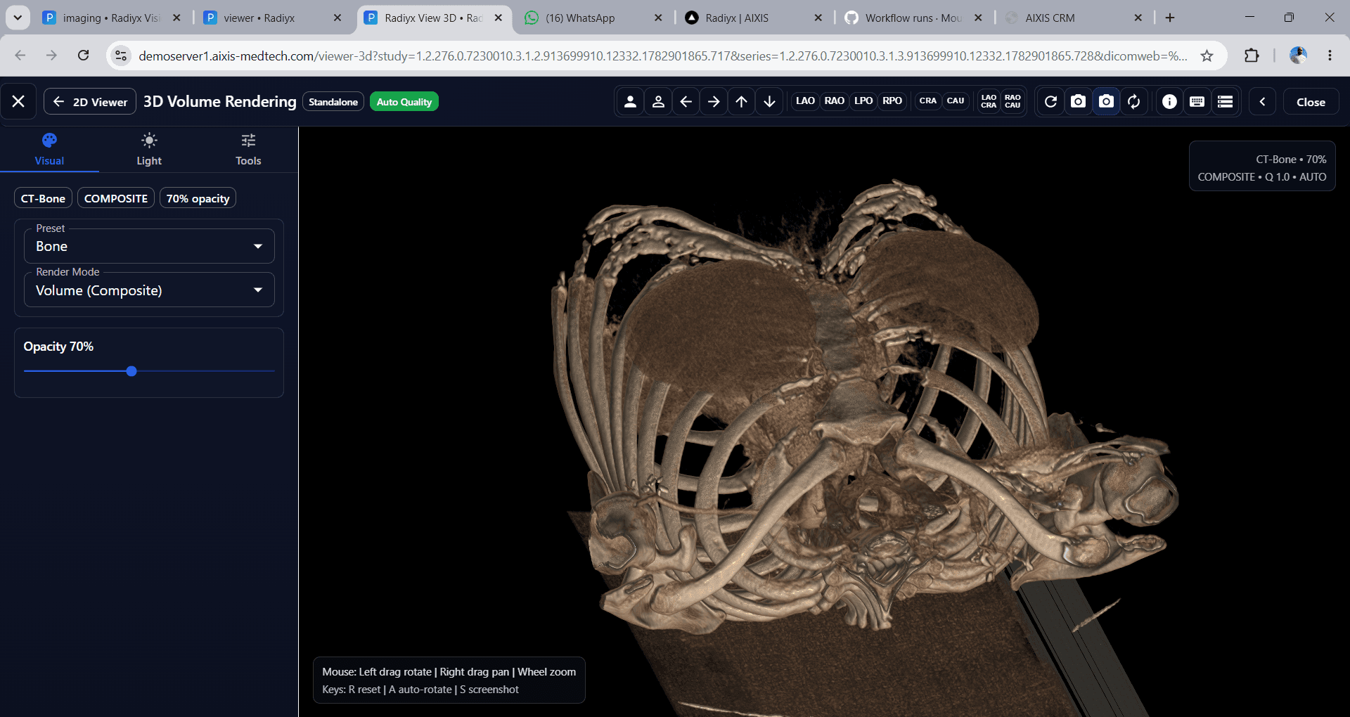 Radiyx View browser-based radiology workspace